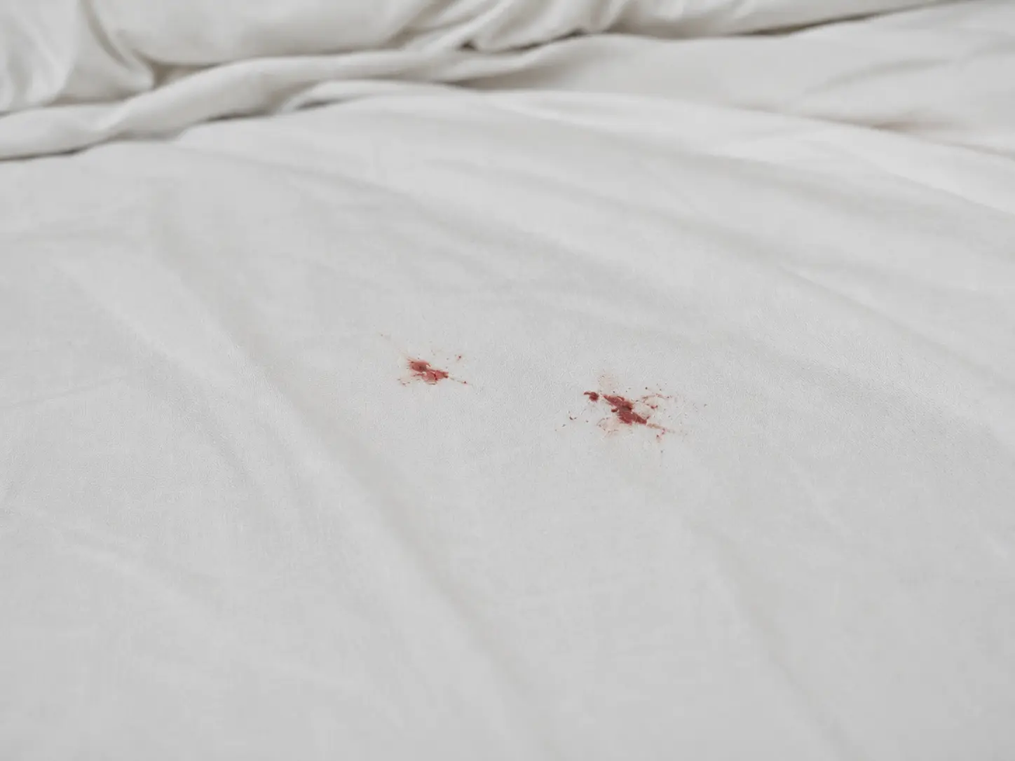Manchas de sangre en la ropa de cama